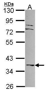 Adenylate kinase 4 Rabbit Polyclonal Antibody