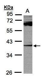 DUSP7 Rabbit Polyclonal Antibody