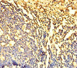 DYNLL1 Antibody