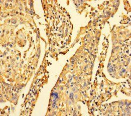 DYNLL1 Antibody