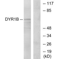 DYRK1B Antibody