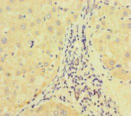 E2F1 Antibody