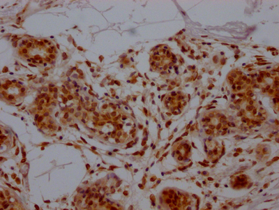 E2F1 Antibody