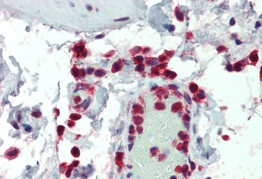 NCF1/p47phox Antibody