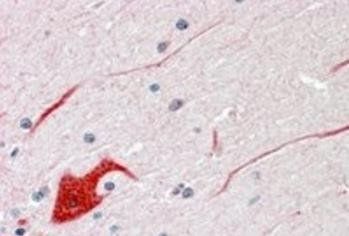 SHP2/PTPN11 Antibody