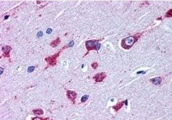 Alsin/ALS2 Antibody