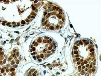 APE1/APEX1 Antibody