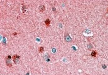PEBP1 Antibody