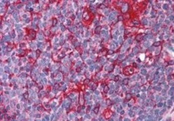 Goat anti-GTRAP3-18 / JWA Antibody