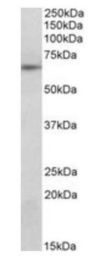 SOCS5 Antibody