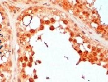UBC3B Antibody