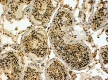 EDD1/HYD Antibody