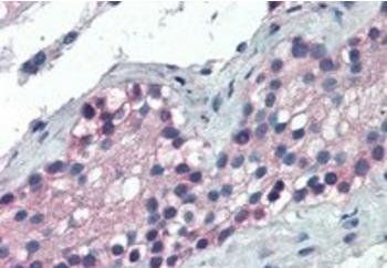 Goat anti-FOXE1 / TTF2 Antibody