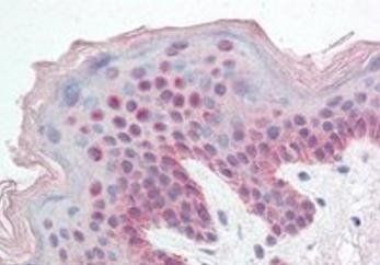 FBXL10/PCCX2 Antibody