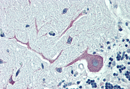 ORP1 Antibody