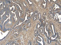 VPS35/MEM3 Antibody