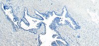 VPS35/MEM3 Antibody