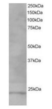 VPS28 Antibody