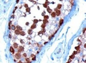 Goat anti-TCP1 Antibody