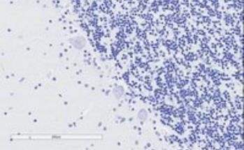 SNAP25 Antibody