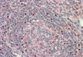 CTDSP1 Antibody
