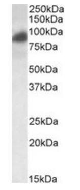 Goat anti-RAB11FIP1 / RCP Antibody