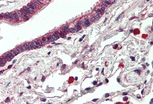 ERBB3/HER3 Antibody