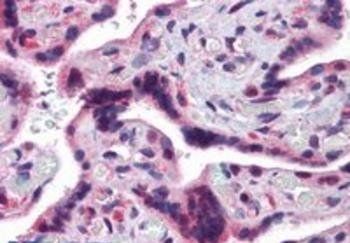 TRAF2 Antibody