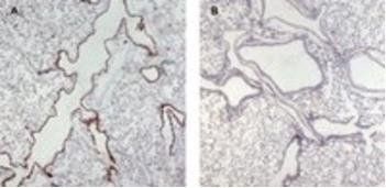 Munc13-4/UNC13D (Internal) Antibody