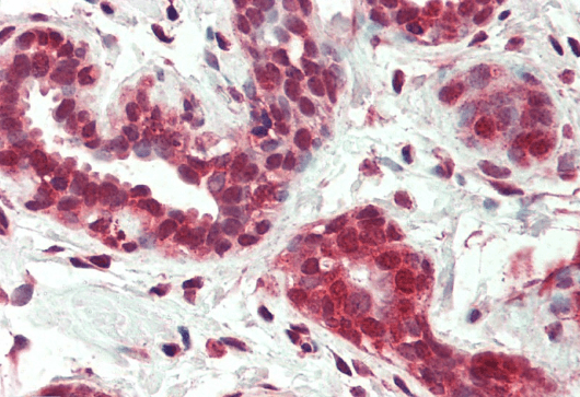 Nur77/TR3 (isoform a) Antibody