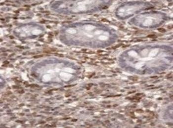 S100A4/CAPL Antibody