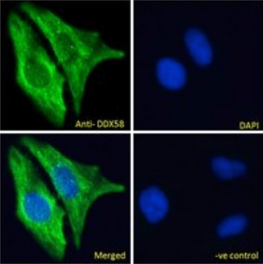 DDX58 Antibody