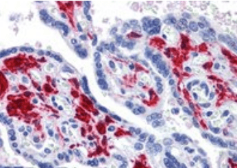 DDX58 Antibody