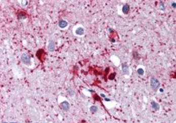 DDX58 Antibody