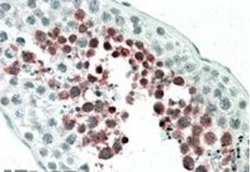 MEPCE Antibody