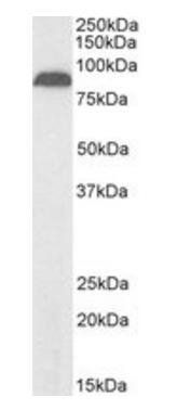 TRPV5, Biotinylated Antibody