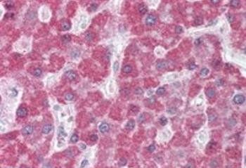MRP5 Antibody