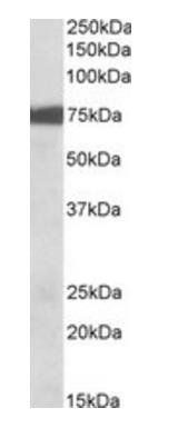 RPS6KA2 Antibody