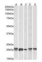 FTL Antibody