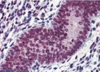 EWS/EWSR1 Antibody