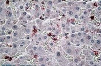 CCL20 Antibody