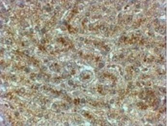 SYVN1 Antibody