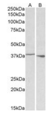 PCBP1 (aa223-234) Antibody