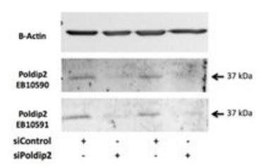POLDIP2 Antibody