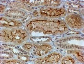 COL4A3 (aa341-353) Antibody