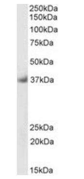 Delta-Sarcoglycan (aa245-257), Biotinylated Antibody