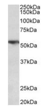 TNFRSF1A/TNFR1 Antibody
