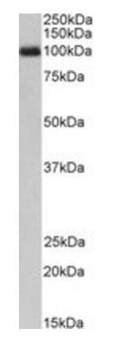 G-CSF receptor/CSF3R (aa551-563) Antibody