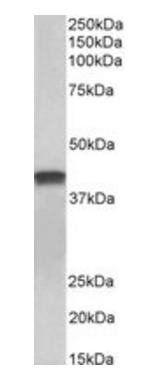 cardiac troponin T (aa201-213) Antibody
