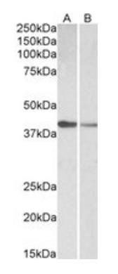 cardiac troponin T (aa201-213) Antibody